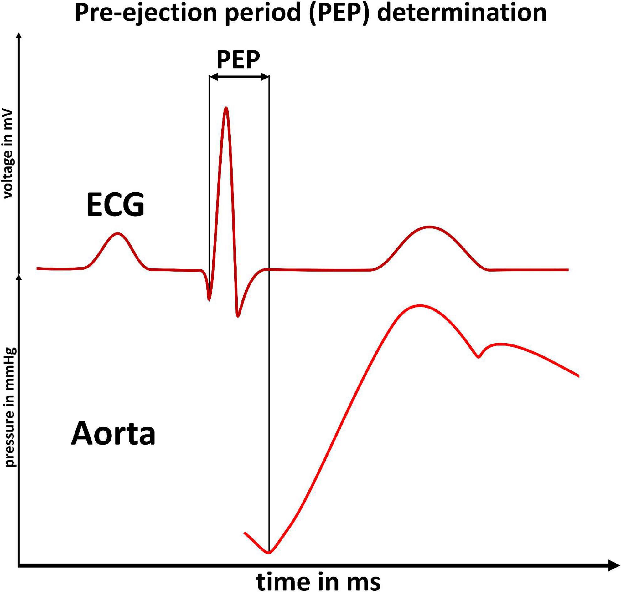 The pre-ejection period is a highly stress dependent parameter of paramount importance for pulse-wave-velocity based applications